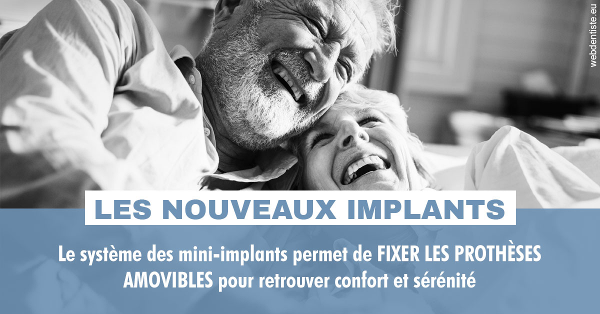 https://dr-mouffok-calle-hourida.chirurgiens-dentistes.fr/Les nouveaux implants 2