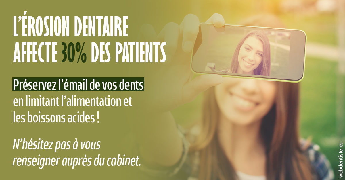 https://dr-mouffok-calle-hourida.chirurgiens-dentistes.fr/L'érosion dentaire 1