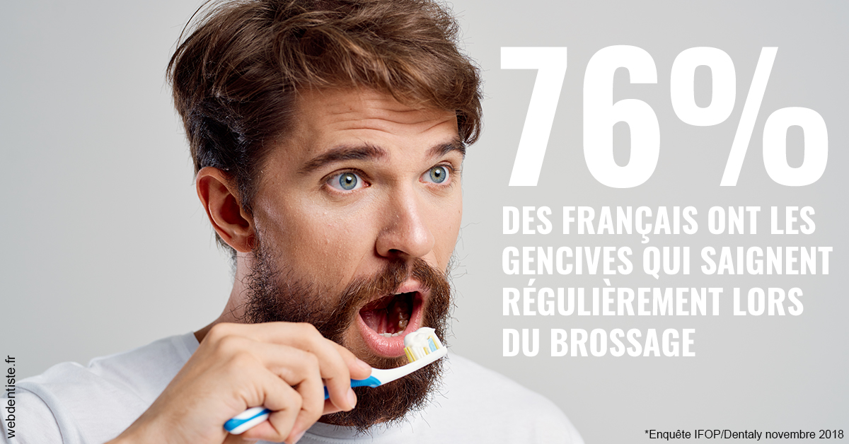 https://dr-mouffok-calle-hourida.chirurgiens-dentistes.fr/76% des Français 2