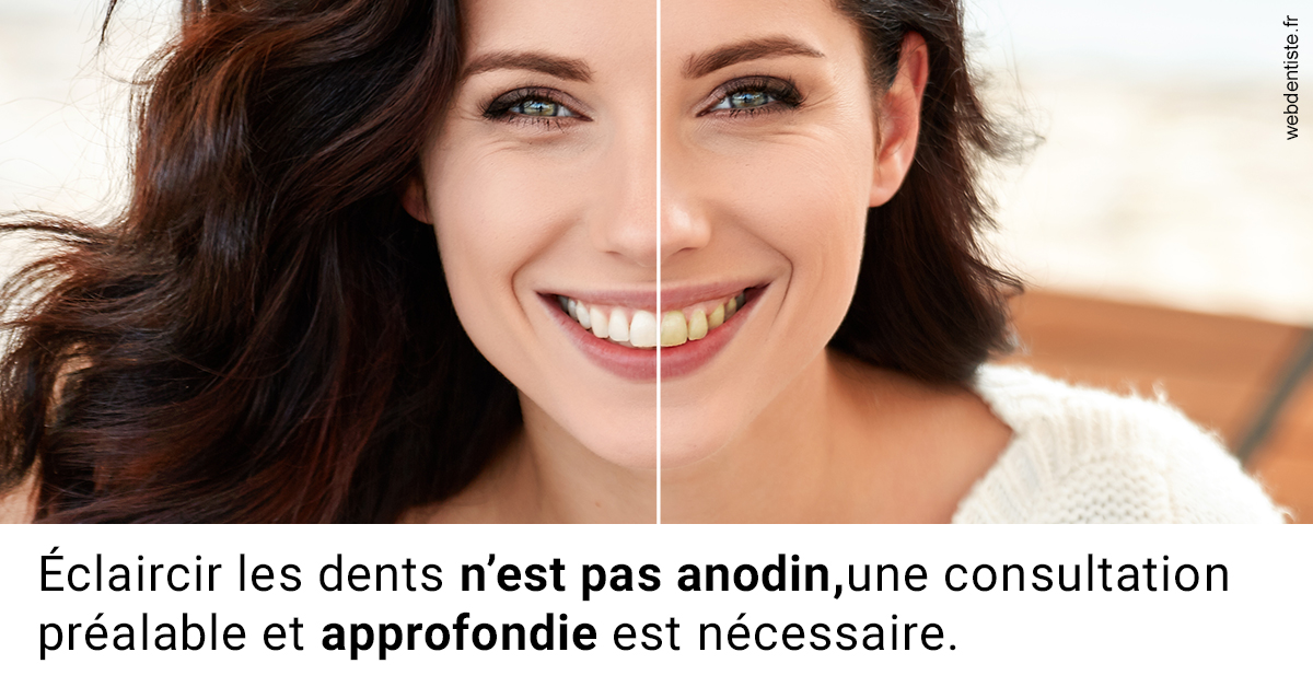https://dr-mouffok-calle-hourida.chirurgiens-dentistes.fr/Le blanchiment 2