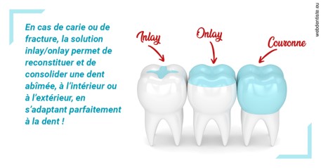 https://dr-mouffok-calle-hourida.chirurgiens-dentistes.fr/L'INLAY ou l'ONLAY
