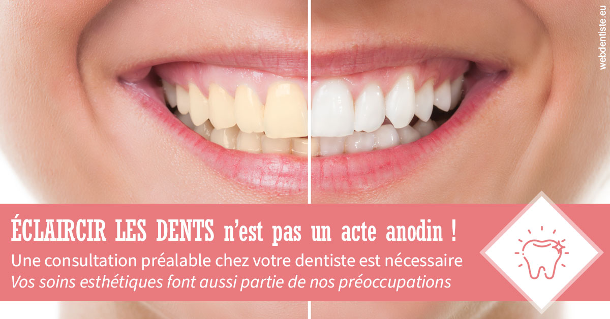 https://dr-mouffok-calle-hourida.chirurgiens-dentistes.fr/Eclaircir les dents 1