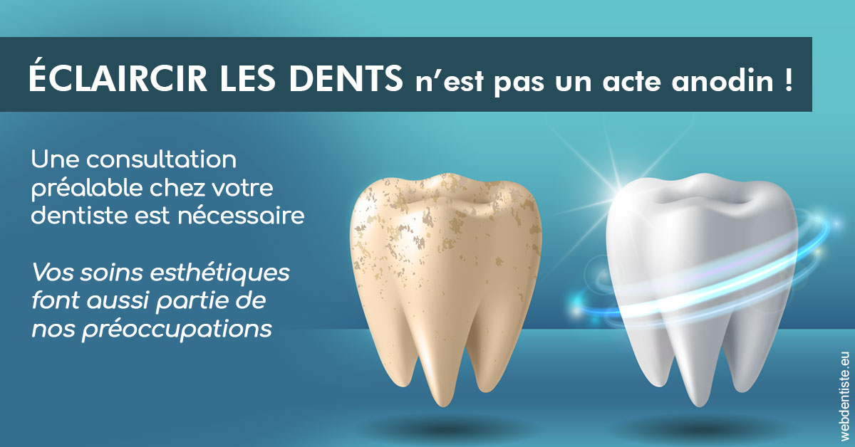 https://dr-mouffok-calle-hourida.chirurgiens-dentistes.fr/Eclaircir les dents 2