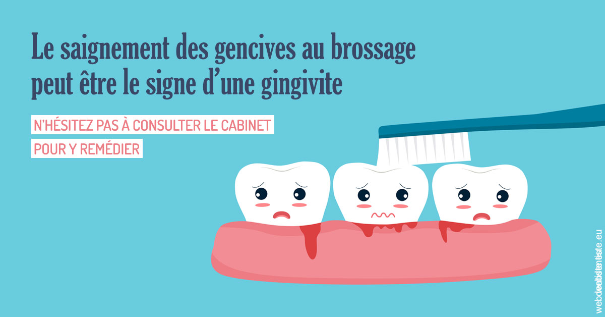https://dr-mouffok-calle-hourida.chirurgiens-dentistes.fr/Saignement gencives 2