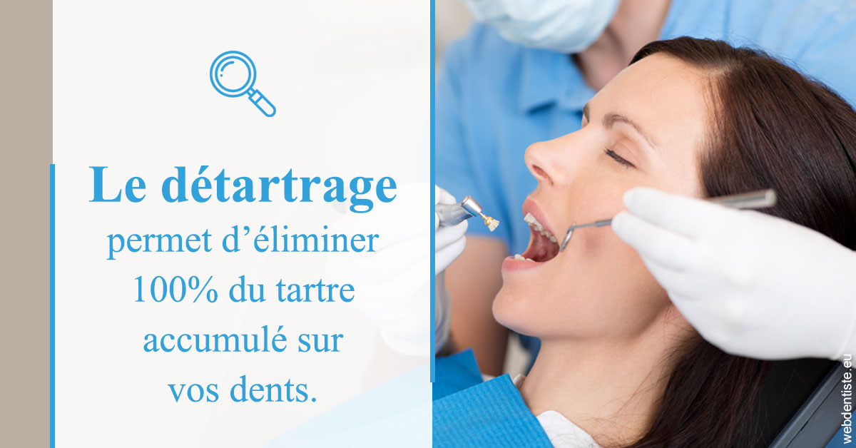 https://dr-mouffok-calle-hourida.chirurgiens-dentistes.fr/En quoi consiste le détartrage