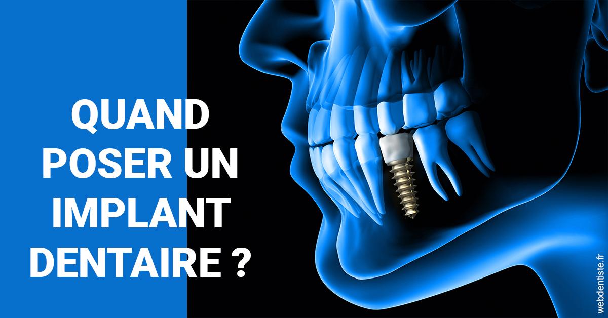 https://dr-mouffok-calle-hourida.chirurgiens-dentistes.fr/Les implants 1