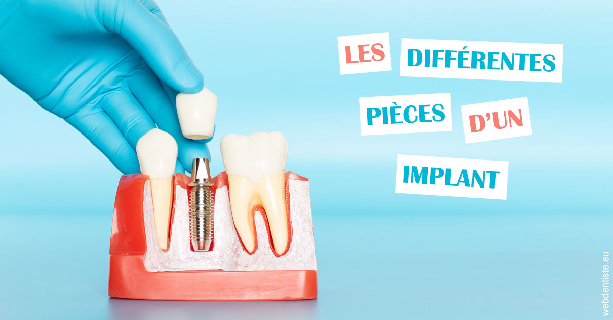 https://dr-mouffok-calle-hourida.chirurgiens-dentistes.fr/Les différentes pièces d’un implant 2