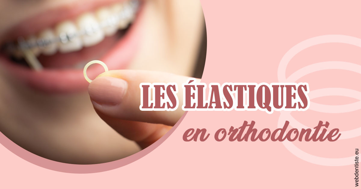https://dr-mouffok-calle-hourida.chirurgiens-dentistes.fr/Elastiques orthodontie 1