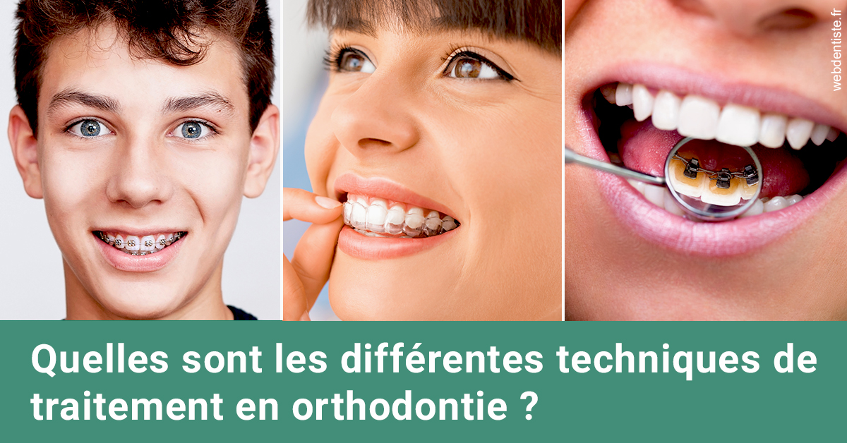https://dr-mouffok-calle-hourida.chirurgiens-dentistes.fr/Les différentes techniques de traitement 2
