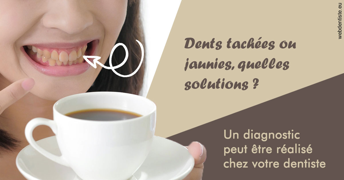 https://dr-mouffok-calle-hourida.chirurgiens-dentistes.fr/Dents tachées 1