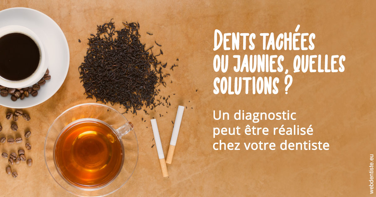 https://dr-mouffok-calle-hourida.chirurgiens-dentistes.fr/Dents tachées 2