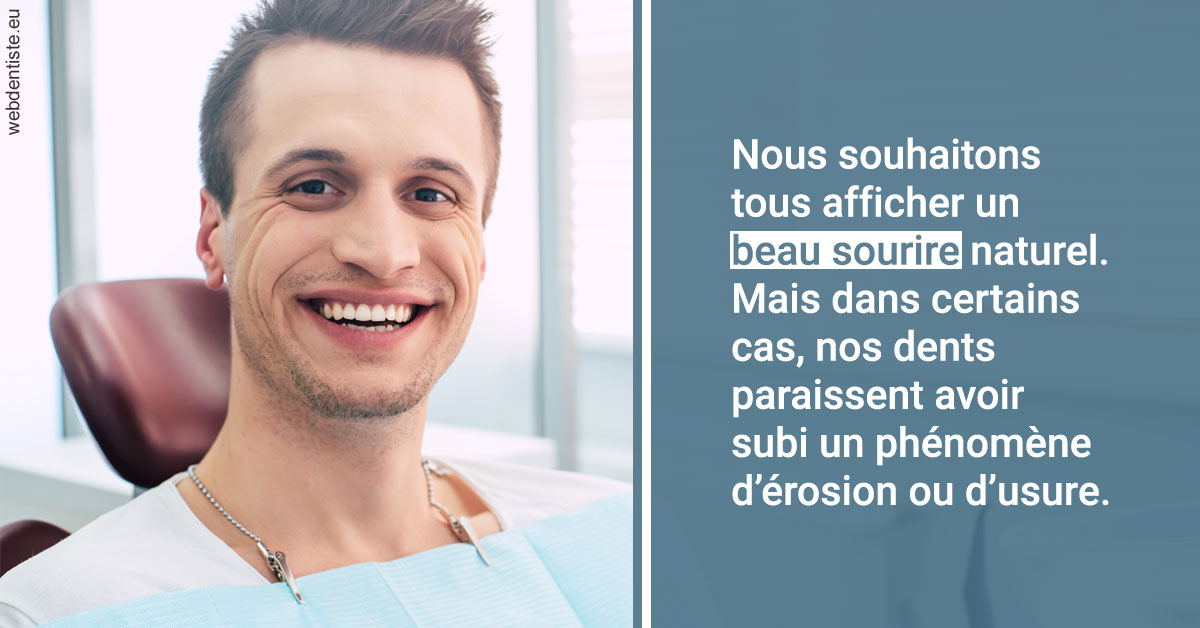 https://dr-mouffok-calle-hourida.chirurgiens-dentistes.fr/Érosion et usure dentaire