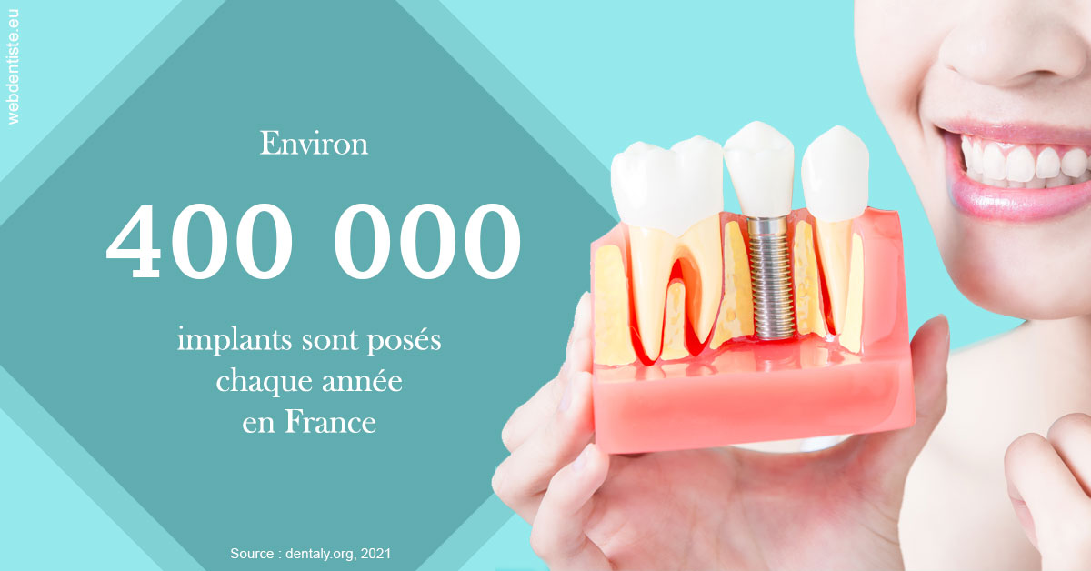 https://dr-mouffok-calle-hourida.chirurgiens-dentistes.fr/Pose d'implants en France 2